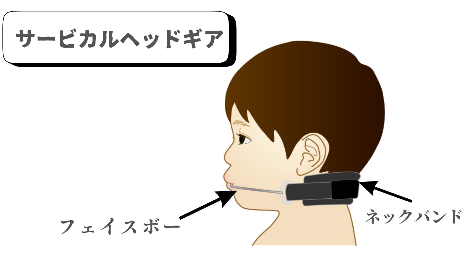 【ヘッドギアってなに?】矯正治療で使用される事があるヘッドギア装置を詳しく解説します! | 三重県四日市の矯正歯科【プルチーノ歯科・矯正歯科 ...