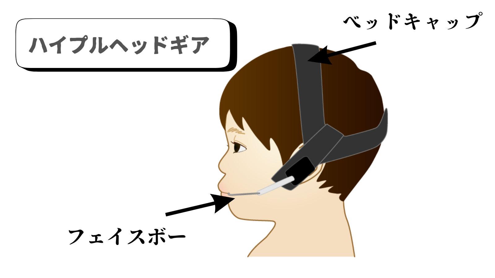 【ヘッドギアってなに?】矯正治療で使用される事があるヘッドギア装置を詳しく解説します! | 三重県四日市の矯正歯科【プルチーノ歯科・矯正歯科 ...