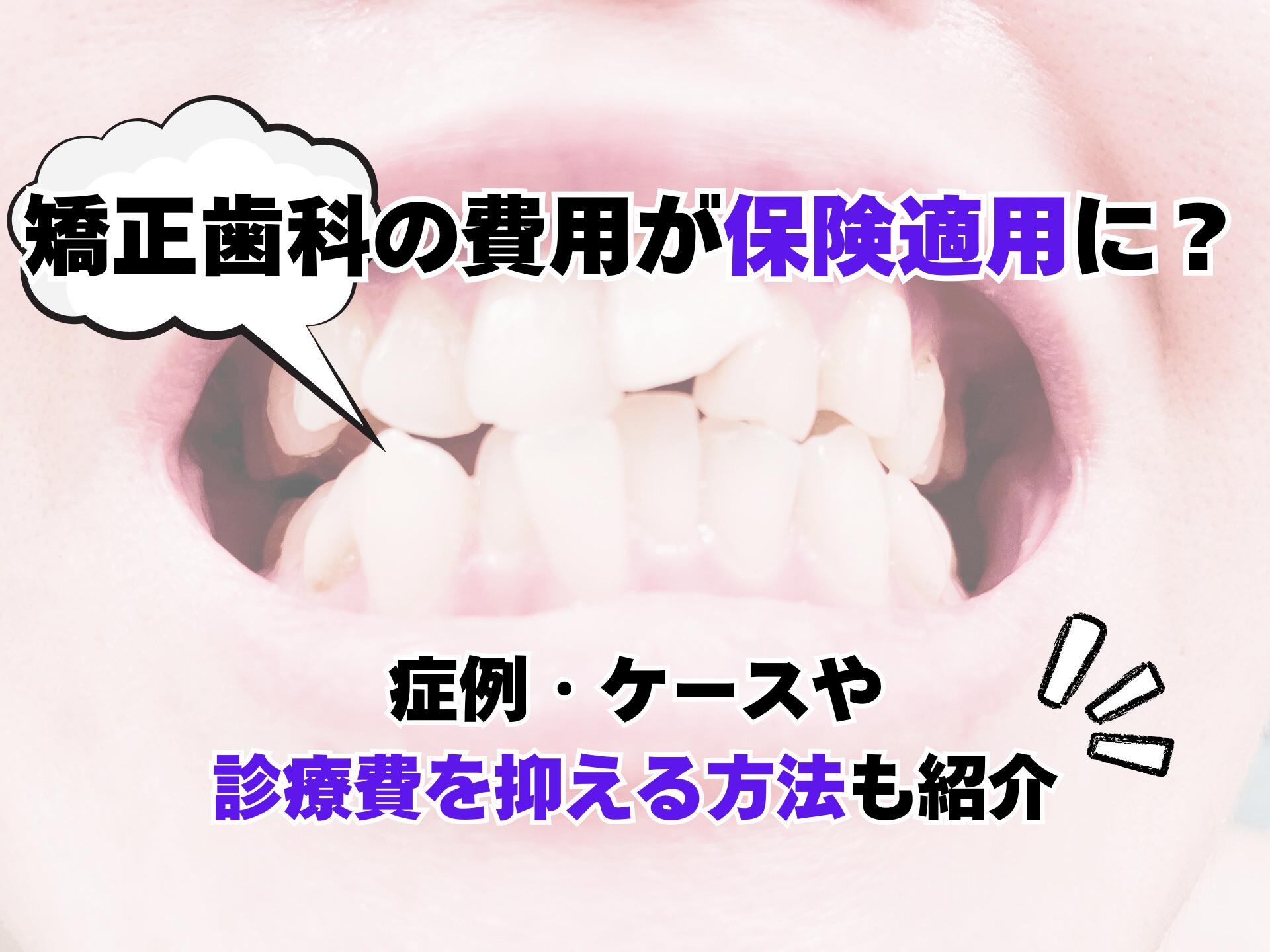 矯正歯科治療の基本と類似症例が必ず見つかる! ラーニングステージ別臨床例