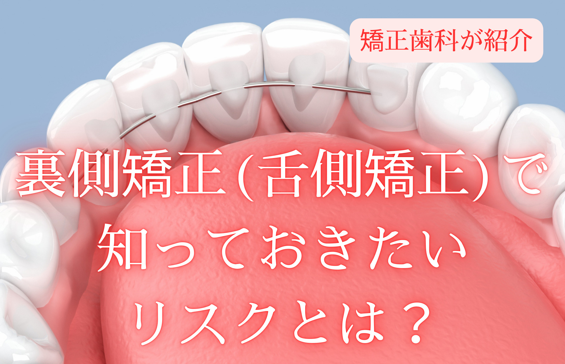 裏側矯正(舌側矯正)で知っておきたいリスクとは？矯正歯科が紹介